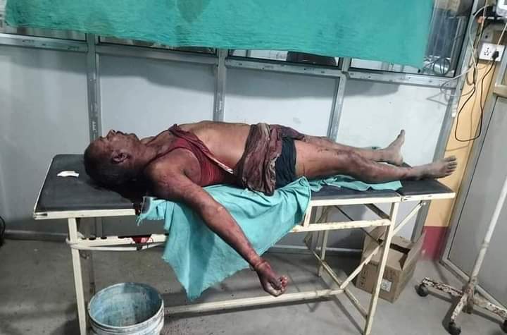 रौतहटमा शनिबार गोली लागेर एक जनाको मृत्यु ,तीन जना घाइते ।